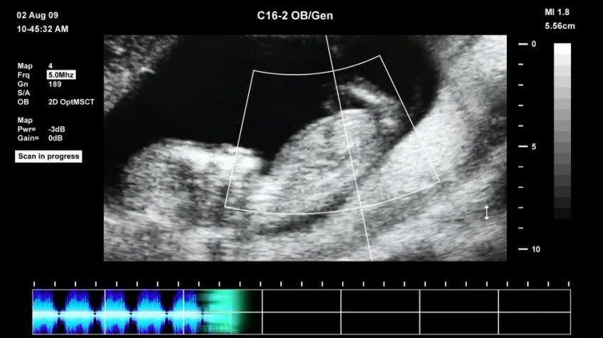 抖音快手无人直播胎教助眠全攻略：教程、软件与素材合集