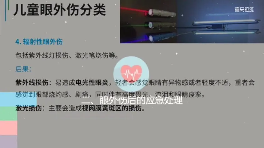 儿童护眼必修课：近视防控与18种眼疾早期识别指南