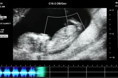 抖音快手无人直播胎教助眠全攻略：教程、软件与素材合集