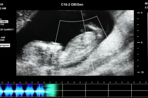 抖音快手无人直播胎教助眠全攻略：教程、软件与素材合集