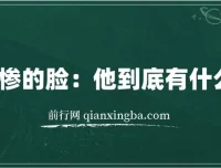 《爱卖惨的脸：他到底有什么目的？》