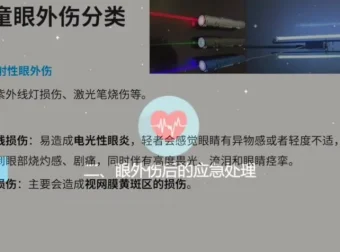 儿童护眼必修课：近视防控与18种眼疾早期识别指南